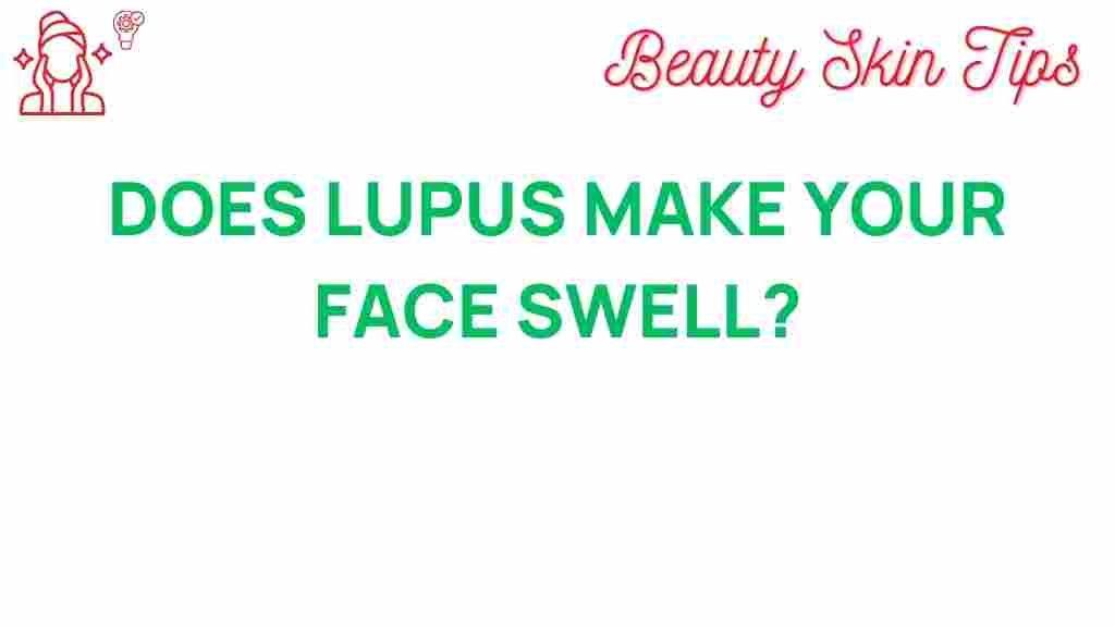 lupus-facial-swelling