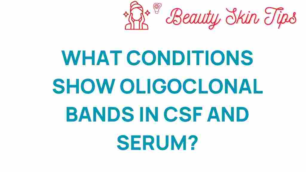 oligoclonal-bands-csf-serum